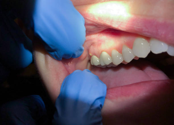 Best Emergency TMJ Treatment in Imperial, NE